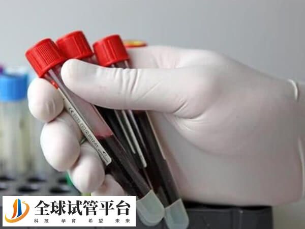 早孕检查不仅仅是为了判断妊娠结果