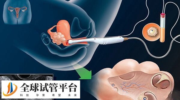 信阳154医院做试管费用是多少？