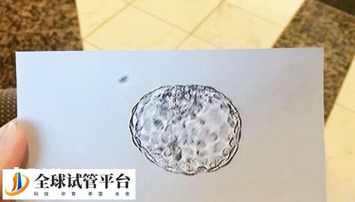 促排打夜针时间因促排方案而异