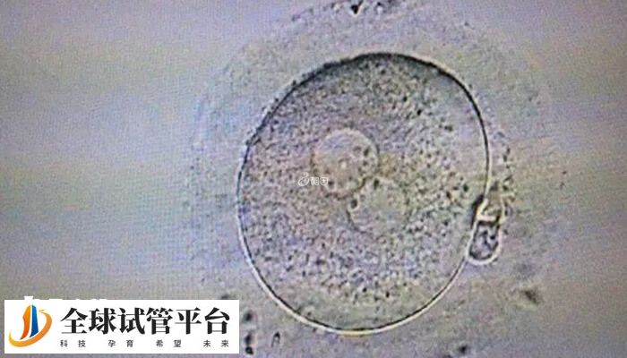 移植一个胚胎可提高妊娠率