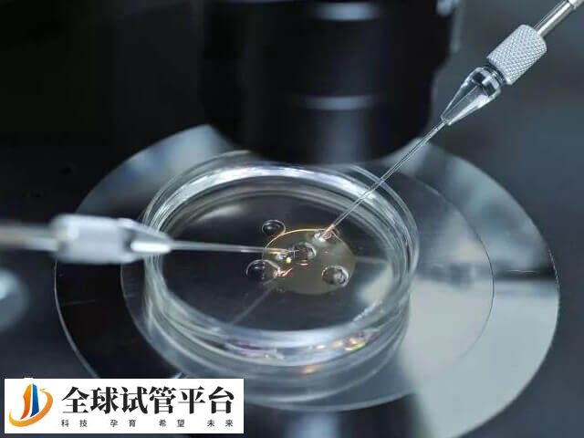 试管移植要进行多个检查