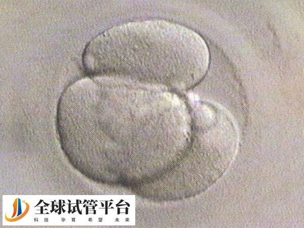 胎停要及时就医