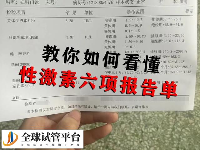 教你如何看懂性激素六项报告单！