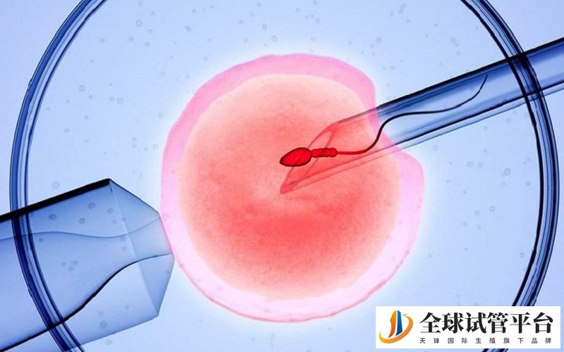 子宫肌瘤能去马来西亚SUNFERT生殖中心做试管么？