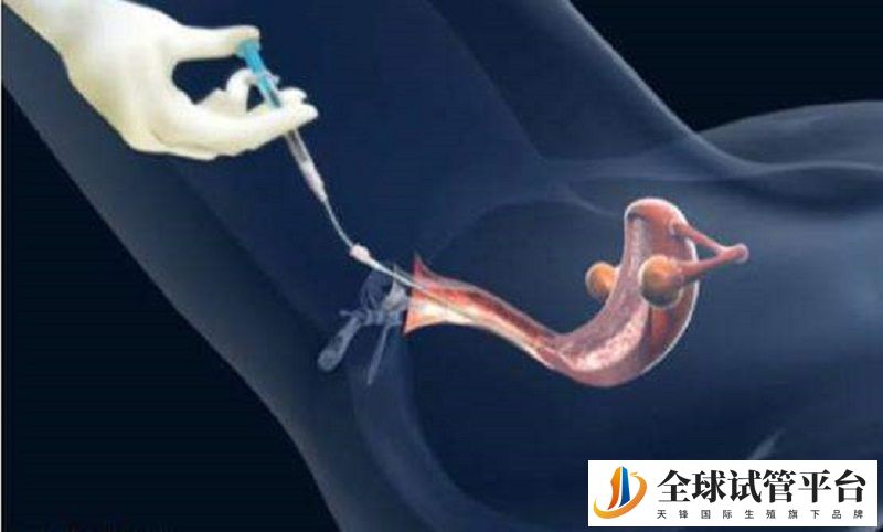 为什么现在人们都喜欢前往柬埔寨做试管生孩子？