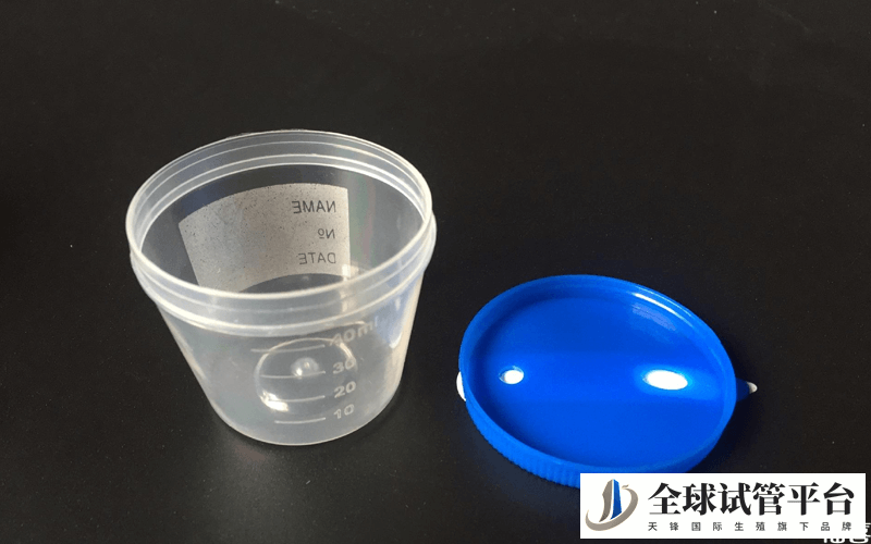 采集尿液的容器
