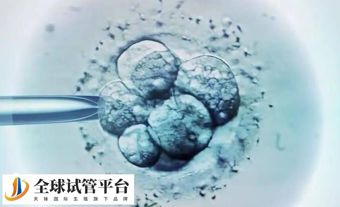 试管移植前注意调整心态