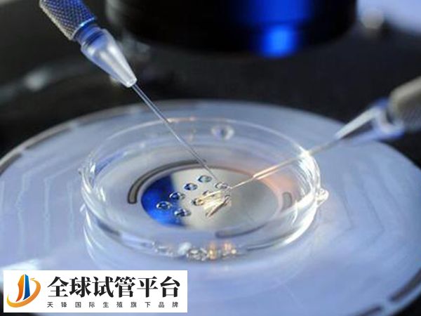 全国首批开展试管的医院是北医三院