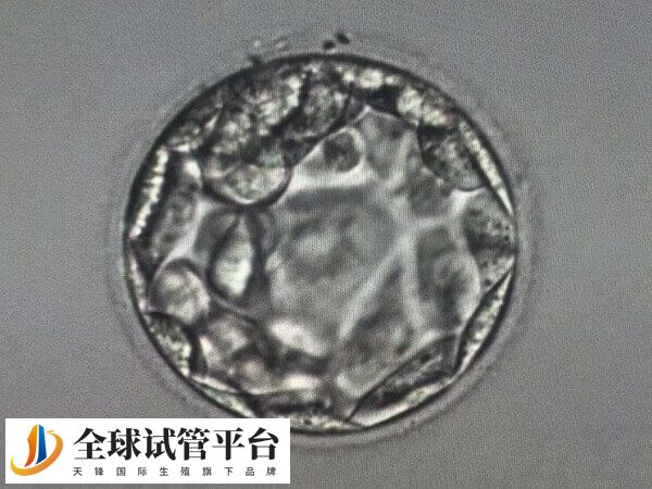 精卵质量差会影响胚胎发育