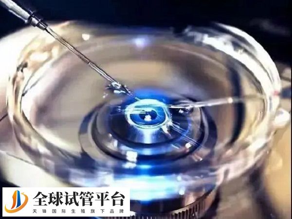 冻卵需要满足法律条件