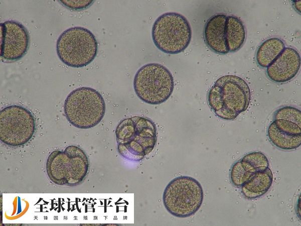 南宁师试管医保能不能异地报销