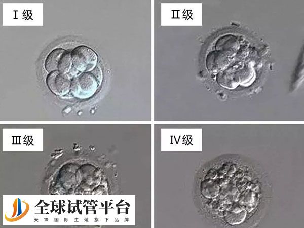 伍琼芳医生是医院生殖医学中心临床负责人