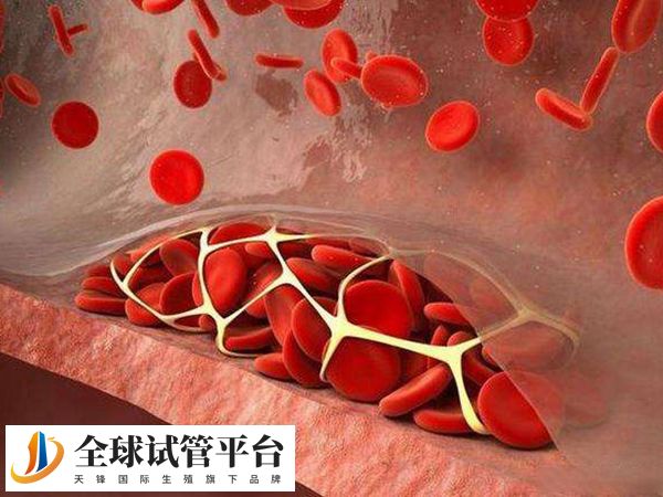 西宁做试管能排除的遗传病有哪些