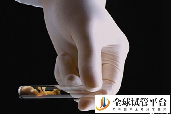 做供卵试管要排队等候