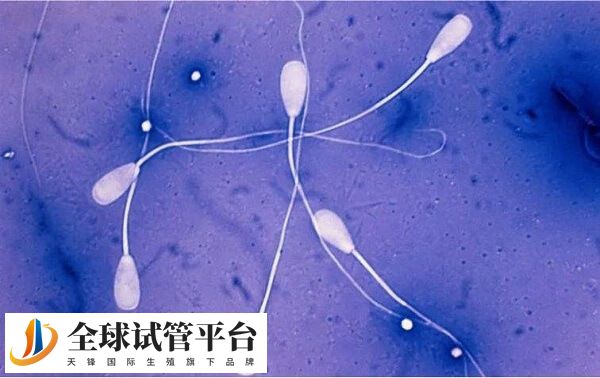 精子检查最好去正规三甲医院