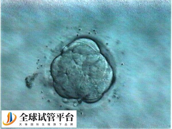 内膜环境差容易影响胚胎着床