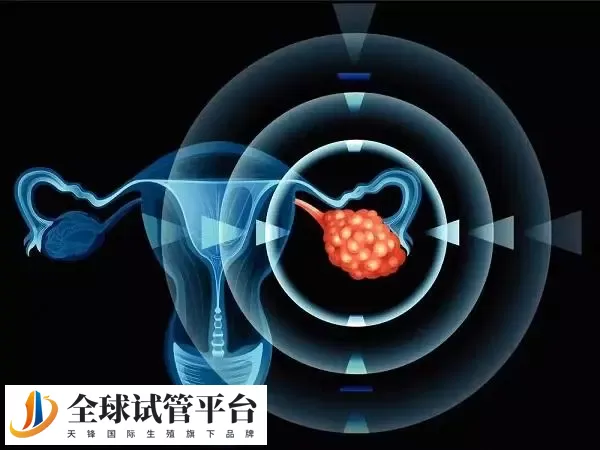 卵巢功能下降会影响卵泡发育
