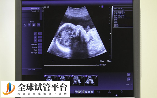 fsh10.8做试管成功率不高