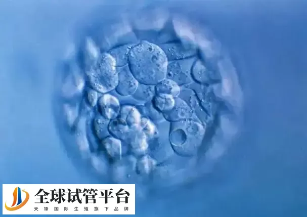 济南私立医院做三代试管可以选男女吗，附具体收费清单分享