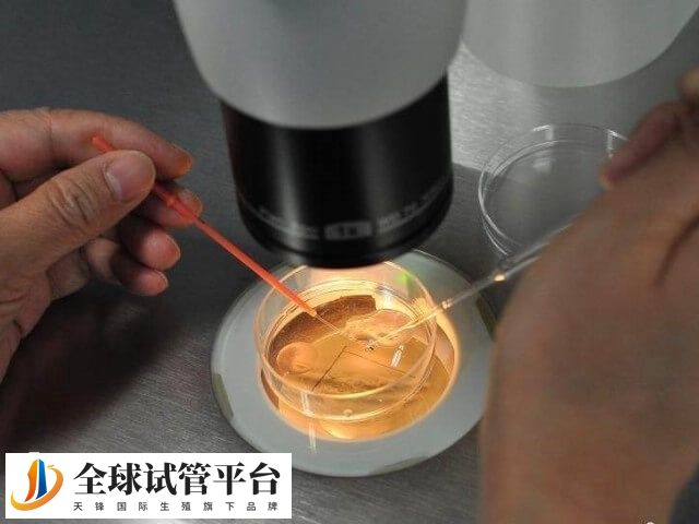 卵子质量差会影响胚胎的质量