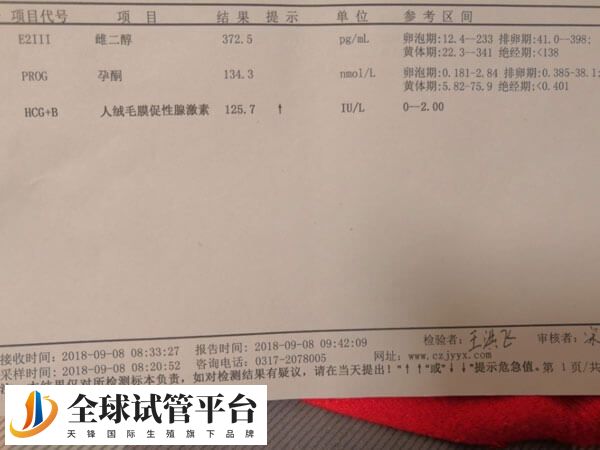 血hcg在怀孕期间对怀孕影响比较大