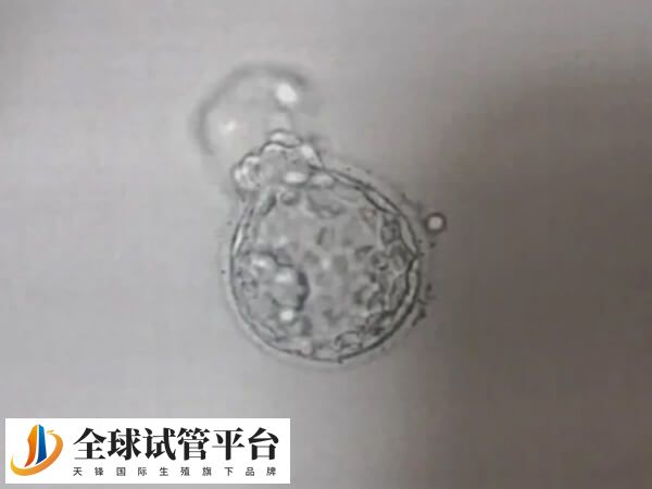 高龄做鲜胚移植成功率低