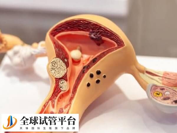 子宫内膜血流阻力高会影响胚胎着床