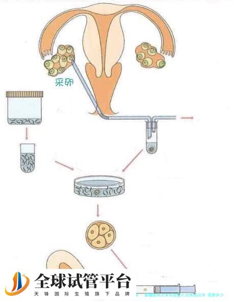 新疆医科大学试管婴儿技术成功率 需要多少钱才能做试管婴儿