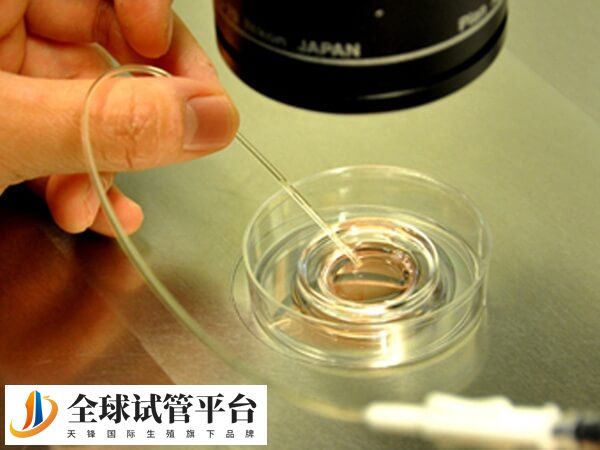 试管费用与技术技术有关