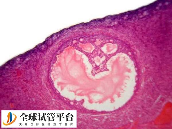 周口本地医院做试管婴儿移植一次手术费用多少？