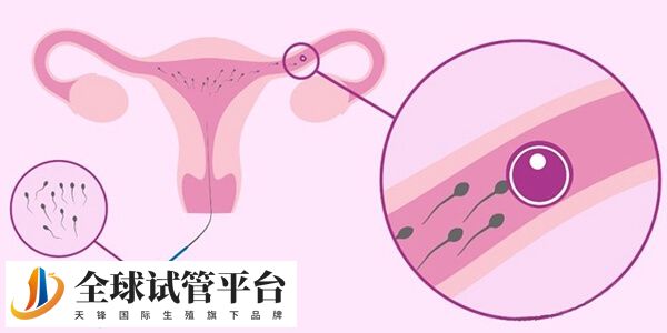 唐山私立医院供精人工授精能选性别吗？