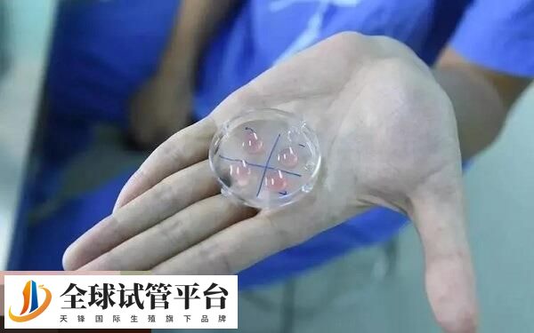 PPOS方案促排时间短