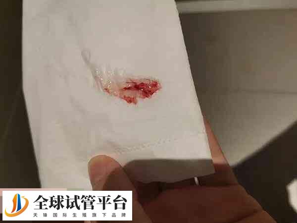 试管移植后少量出血是着床出血