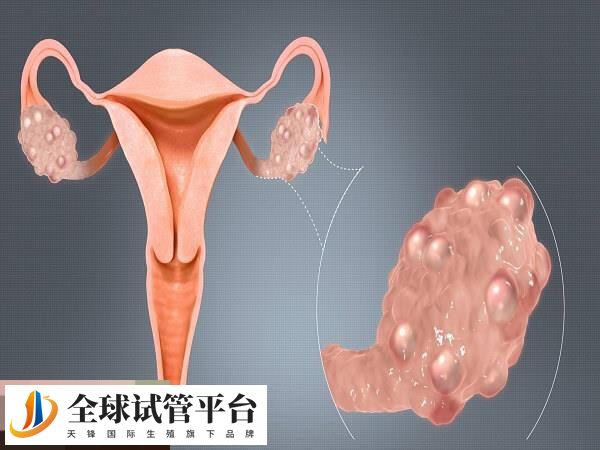 输卵管存在炎症大部分会有积水