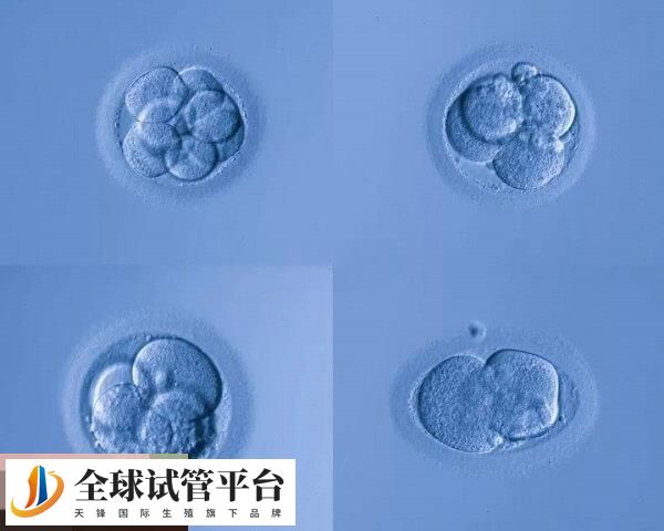 养囊可以提高试管移植成功率