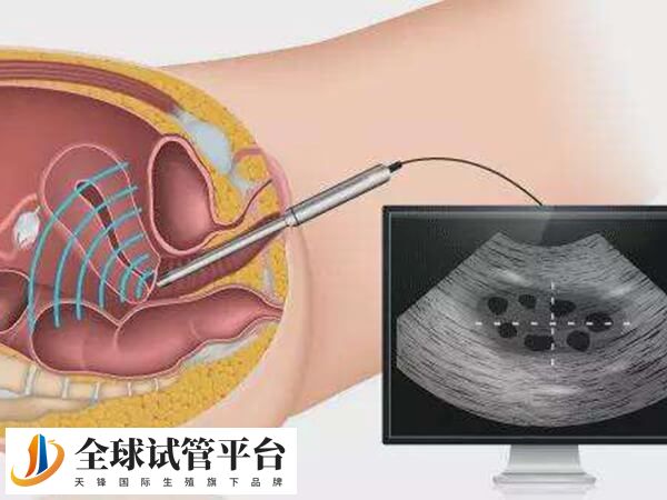 开封妇产医院开展人授技术不到两年