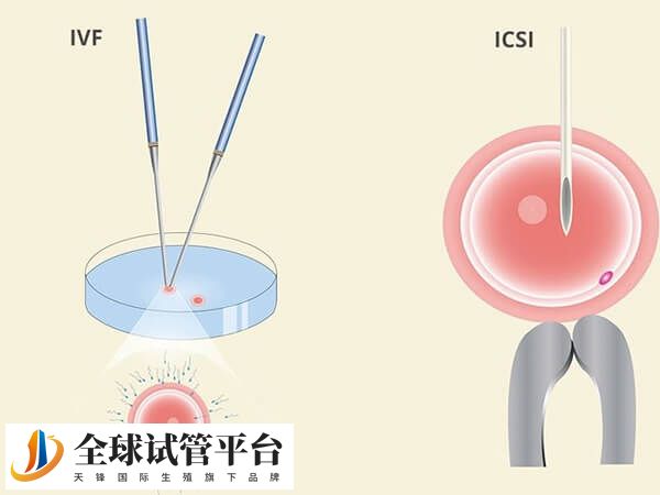 河池市人民医院能做一代试管吗？