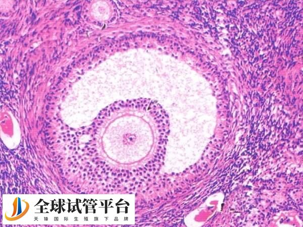 卵泡监测单次收费100元左右