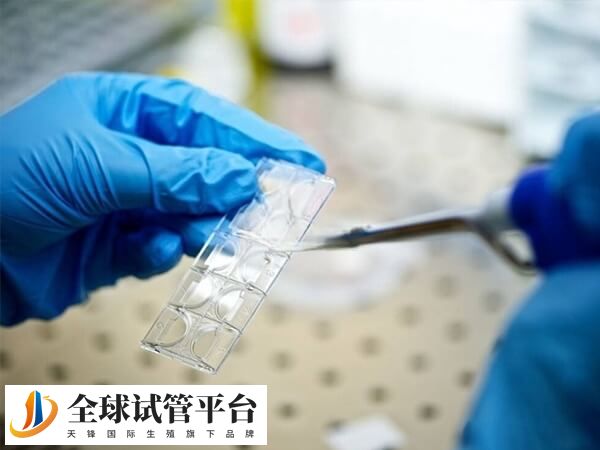 试管婴儿取卵过程并不复杂