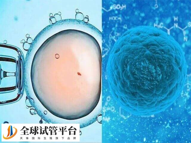 取卵是辅助生殖技术中的一个步骤