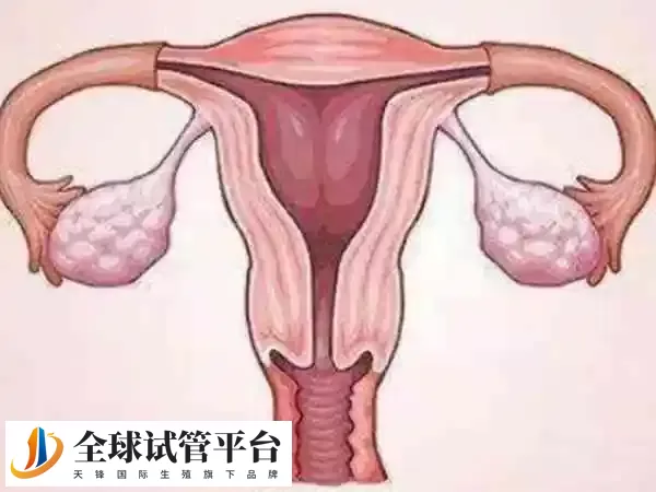 宫外孕是指受精卵在子宫以外的部位着床生长