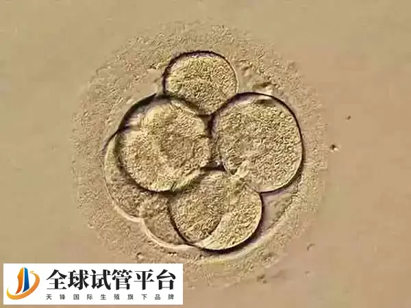 ppos方案是高孕激素促排卵方案