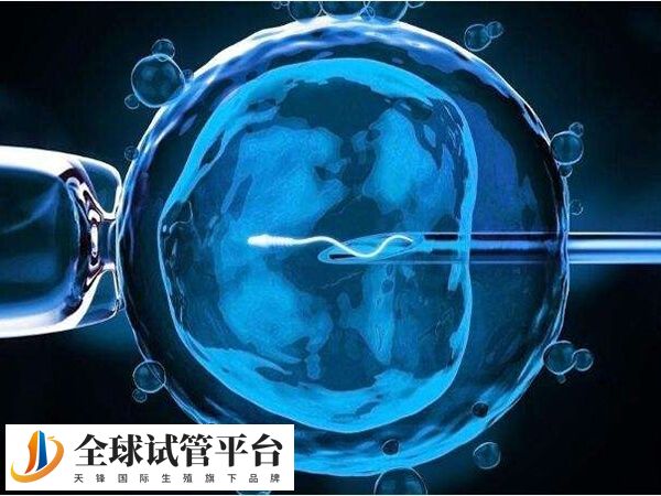 ppos方案促排过程简单