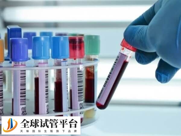 试管治疗前要进行传染病四项筛查