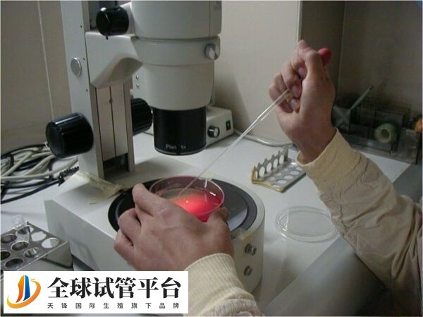 试管术前检查花费时间不长