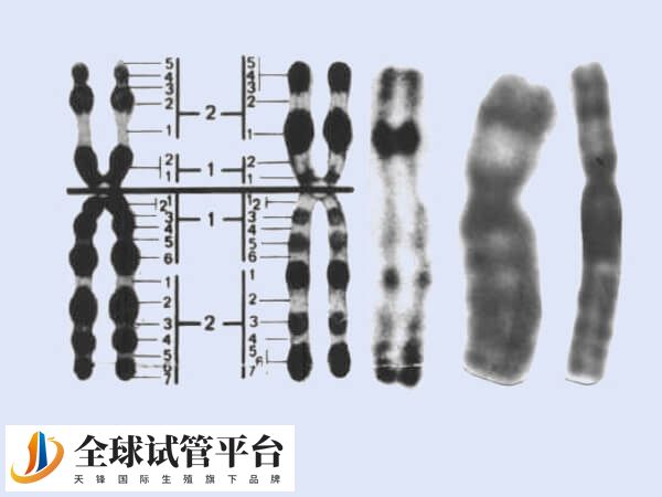 2号染色体易导致精子畸形率高