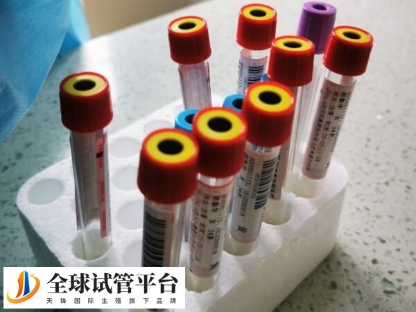 试管怀孕建档要进行血液化验检查