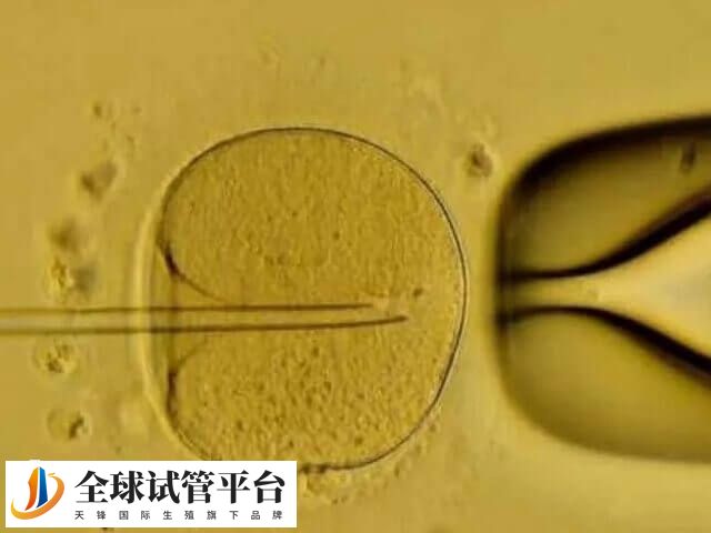 囊胚移植成功率高