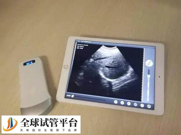 宫外孕指受精卵着床在子宫以外的地方