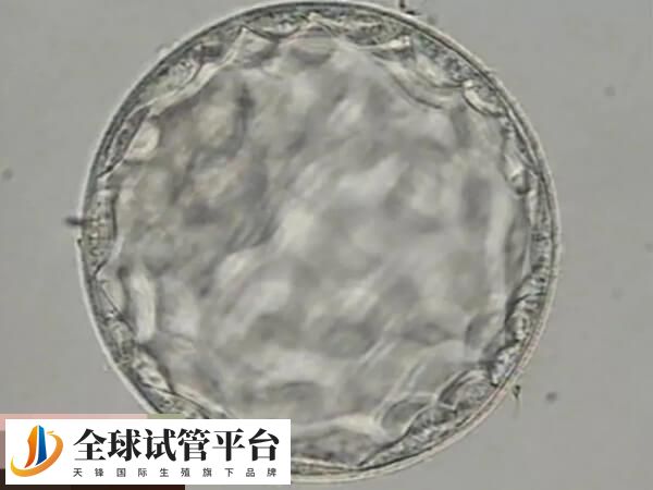 胚胎的质量受到多种因素的影响